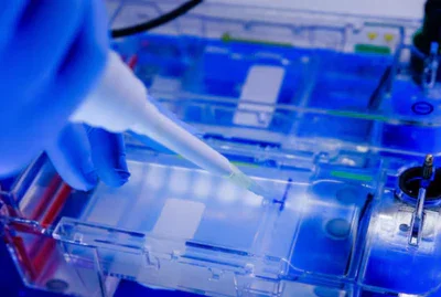 Electrophoresis